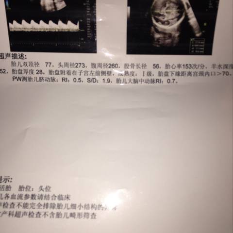 journal_insert_pic_1138414214