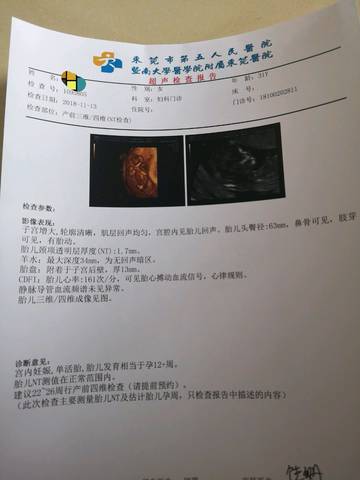 journal_insert_pic_1140184917