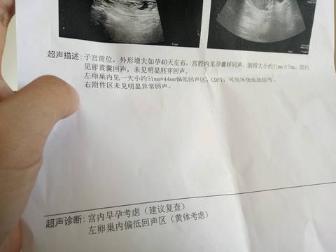 journal_insert_pic_1141292869