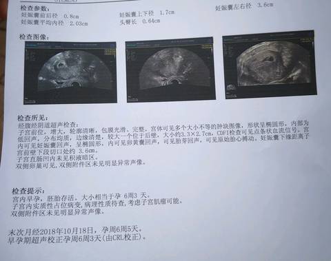 journal_insert_pic_1143085936