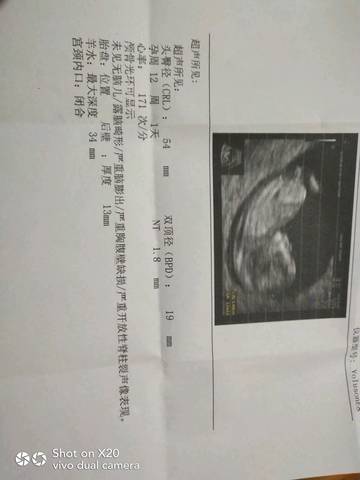 journal_insert_pic_1144380634