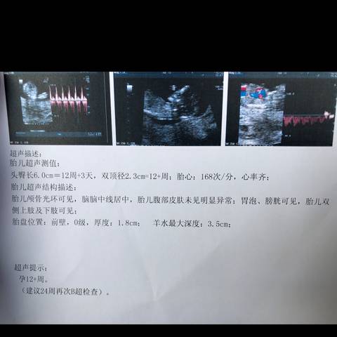 journal_insert_pic_1145697817