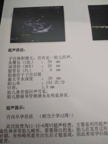 journal_insert_pic_1145703629