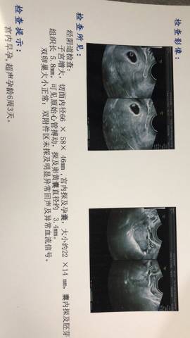 journal_insert_pic_1145881214