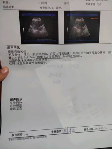 journal_insert_pic_1146955217