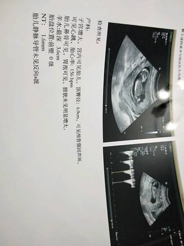 journal_insert_pic_1146931795