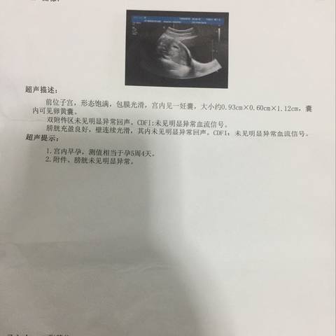 journal_insert_pic_1147238603