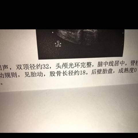 journal_insert_pic_1147568141