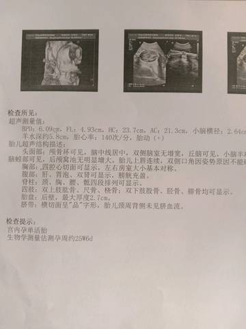 journal_insert_pic_1148033487
