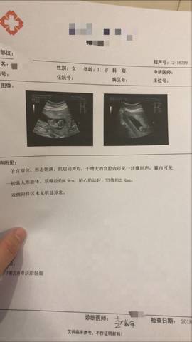 journal_insert_pic_1148215195