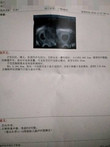 journal_insert_pic_1148703564