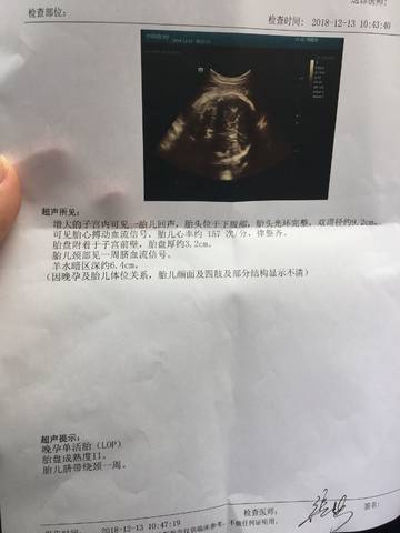 journal_insert_pic_1148981029