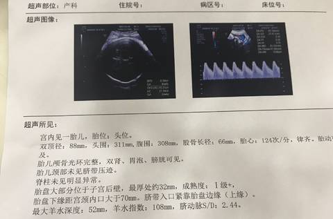journal_insert_pic_1150121479