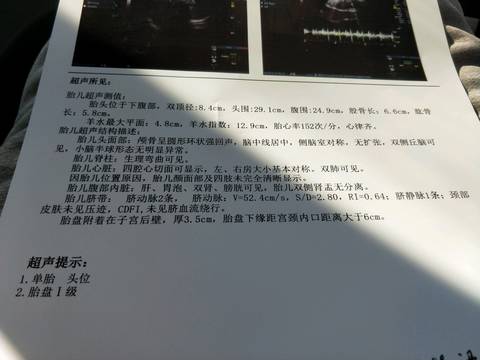 journal_insert_pic_1150229553
