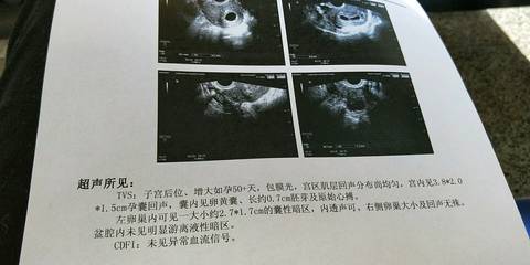 journal_insert_pic_1150296467