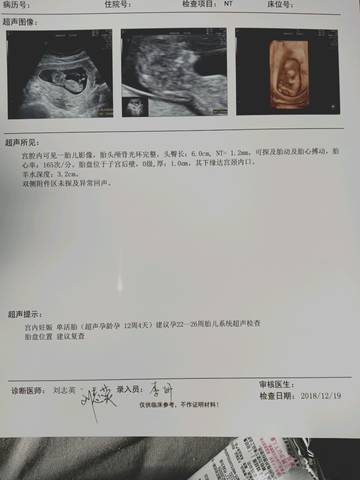 journal_insert_pic_1150789159