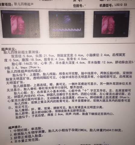 journal_insert_pic_1151067482