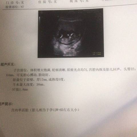 journal_insert_pic_1151029385