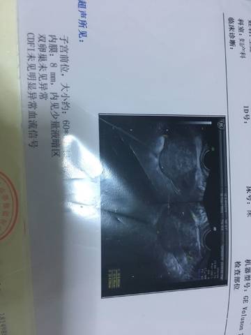 journal_insert_pic_1150894861