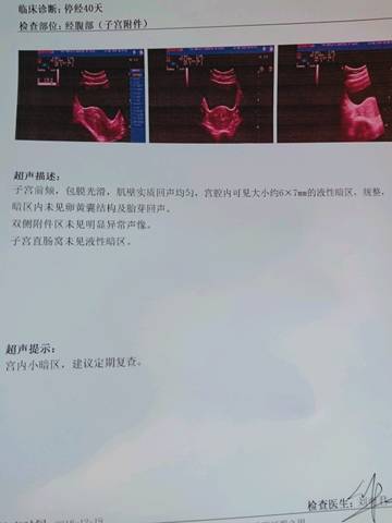 journal_insert_pic_1150697262