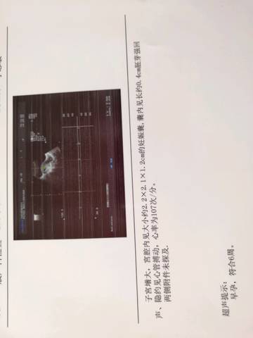 journal_insert_pic_1151796601