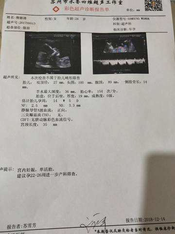 journal_insert_pic_1152249644