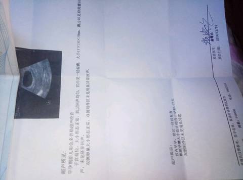 journal_insert_pic_1155524864