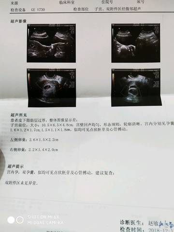 journal_insert_pic_1160386303