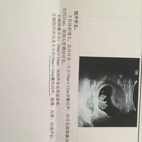 journal_insert_pic_1161353349