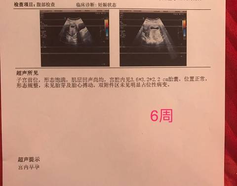 journal_insert_pic_1163489330