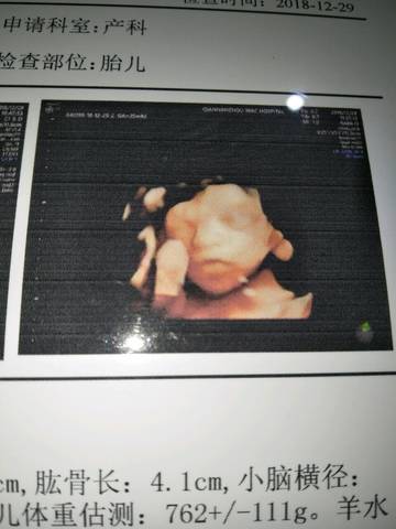 journal_insert_pic_1164634764