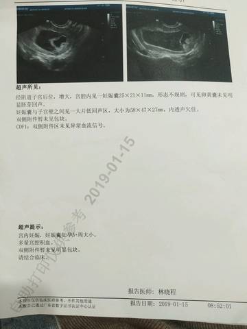 journal_insert_pic_1165523221
