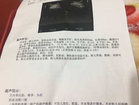 journal_insert_pic_1166217877