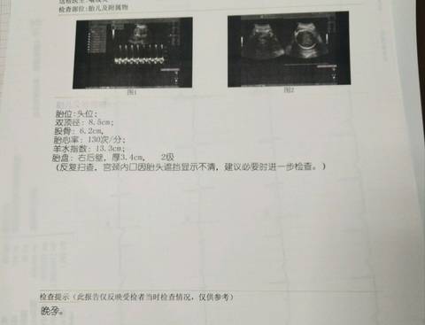 journal_insert_pic_1167100360