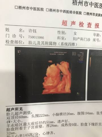 journal_insert_pic_1170093407