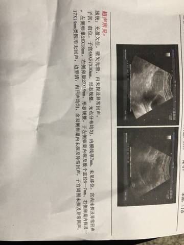 journal_insert_pic_1170170813