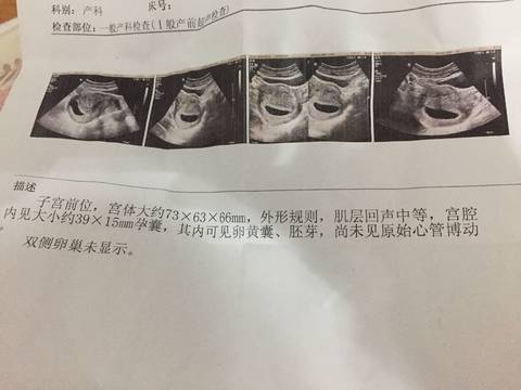 journal_insert_pic_1181160540