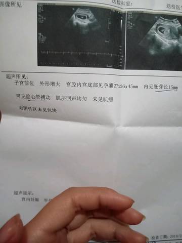 journal_insert_pic_1180816072