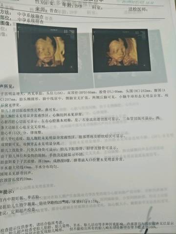 journal_insert_pic_1181756222