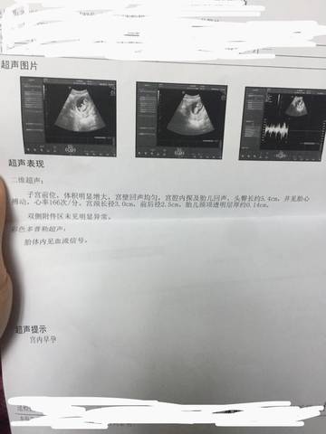 journal_insert_pic_1182529156