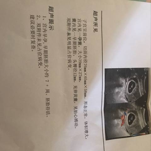 journal_insert_pic_1188037215