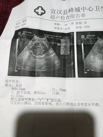 journal_insert_pic_1189222545