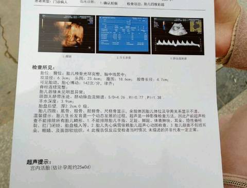 journal_insert_pic_1189338512