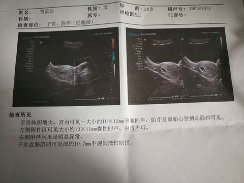 journal_insert_pic_1191066501