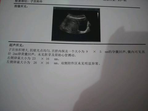 journal_insert_pic_1191494266