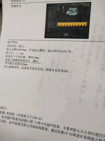 journal_insert_pic_1193770919