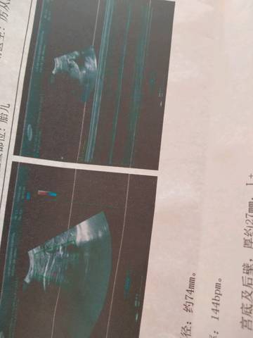 journal_insert_pic_1197553188