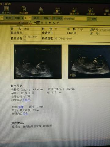 journal_insert_pic_1198880887