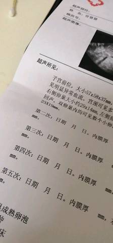 journal_insert_pic_1198913228