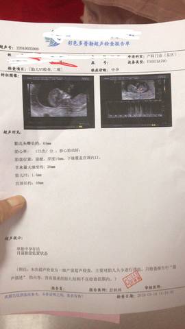 journal_insert_pic_1200675261